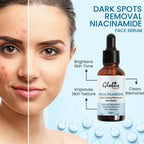 Globus Remedies Niacinamide Anti-Pigmentation Face Serum - Distacart