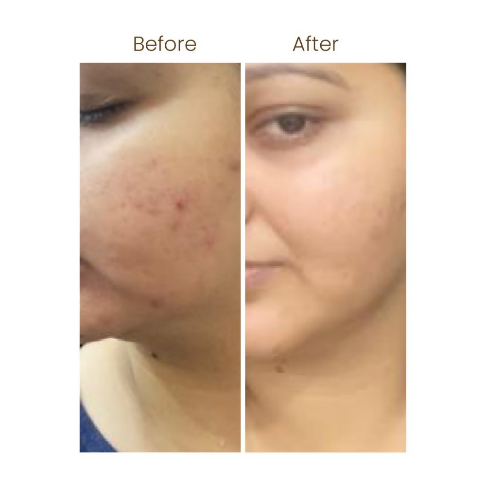Personal Touch Aquarize Toner + Mist With Hyaluranic Acid For Intense Hydration All Skin Type - Distacart