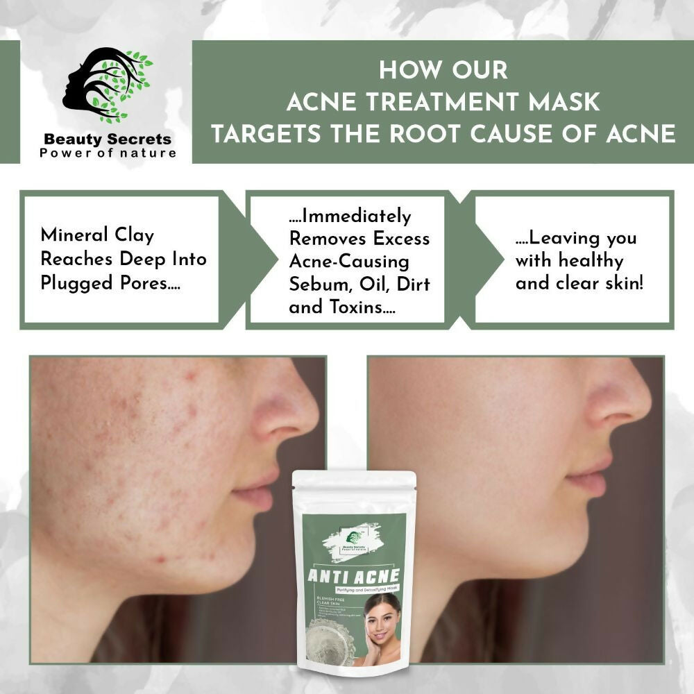 Beauty Secrets Anti Acne Face Mask - Distacart