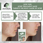 Beauty Secrets Anti Acne Face Mask - Distacart