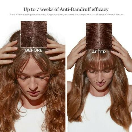 Kerastase Symbiose Bain Pureté Anti-Dandruff Shampoo
