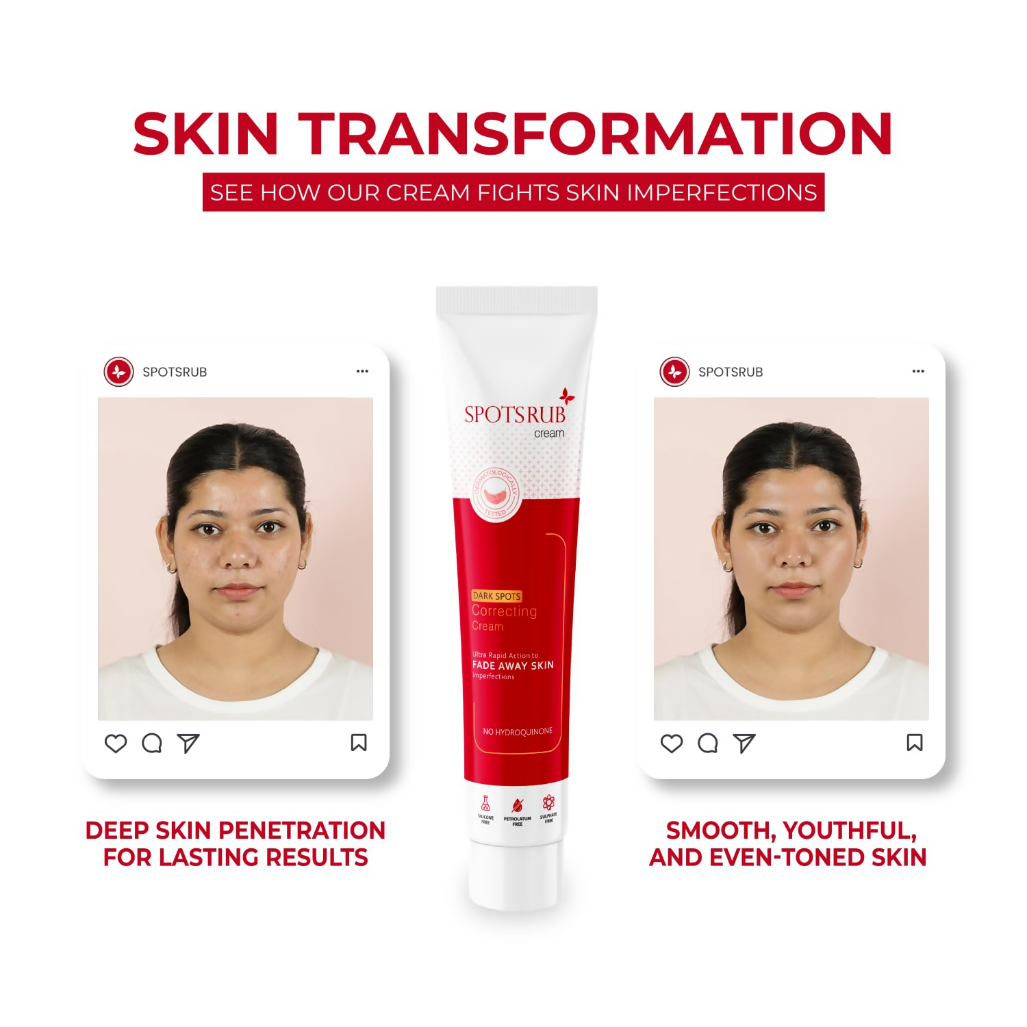Leeford Spotsrub Face Cream For Women - Distacart